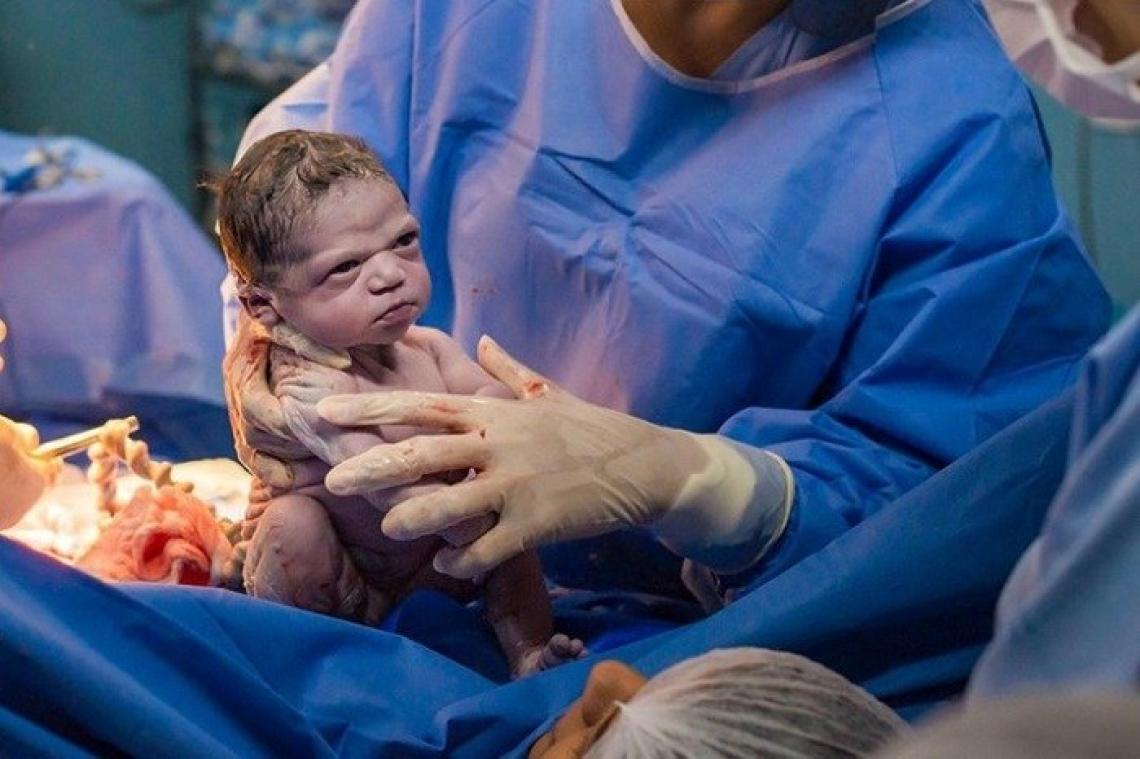 Le regard assassin de ce nouveau-né vers le médecin devient viral