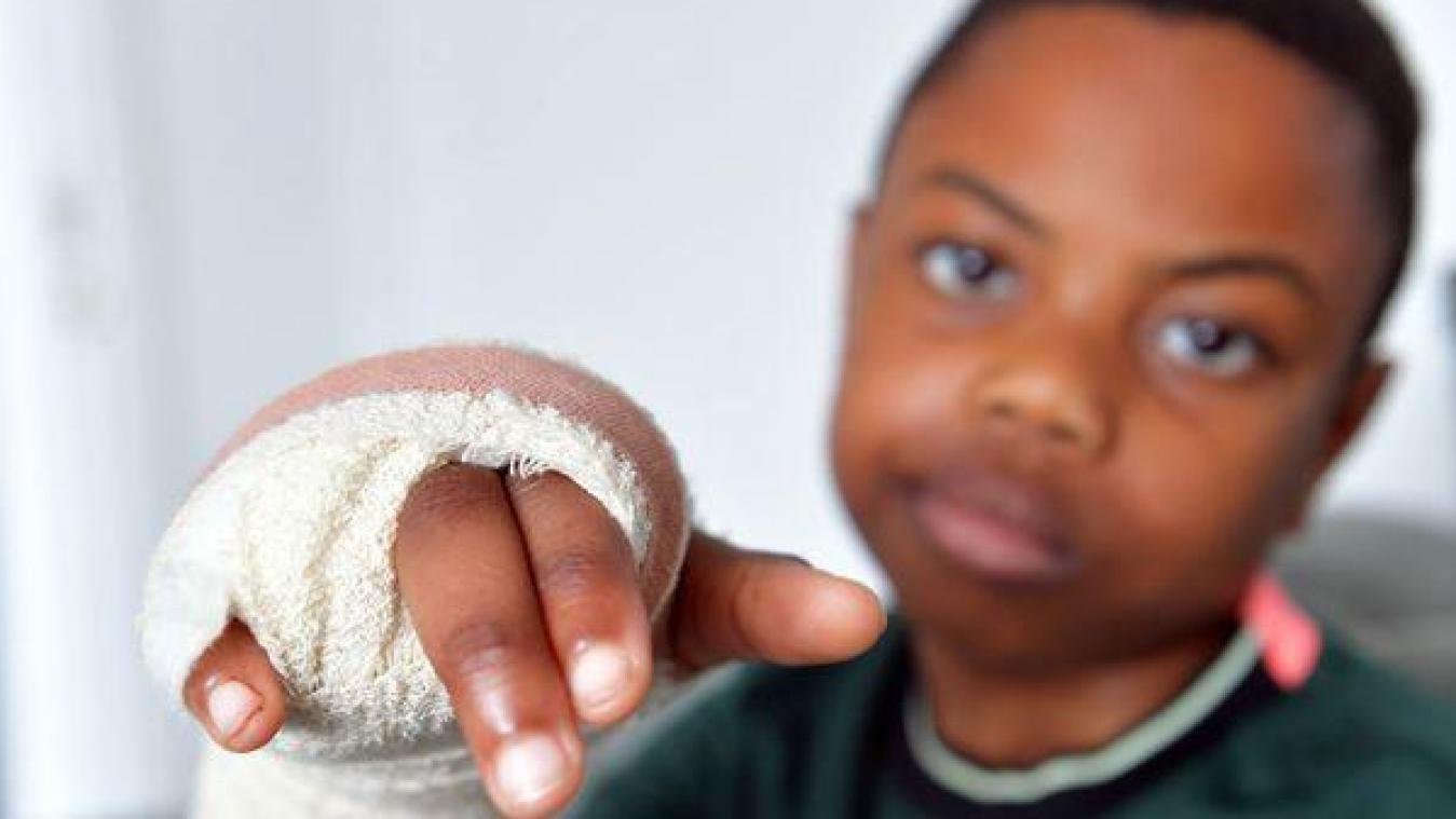 Un enfant de 11 ans amputé d’un doigt après avoir fui des harceleurs racistes