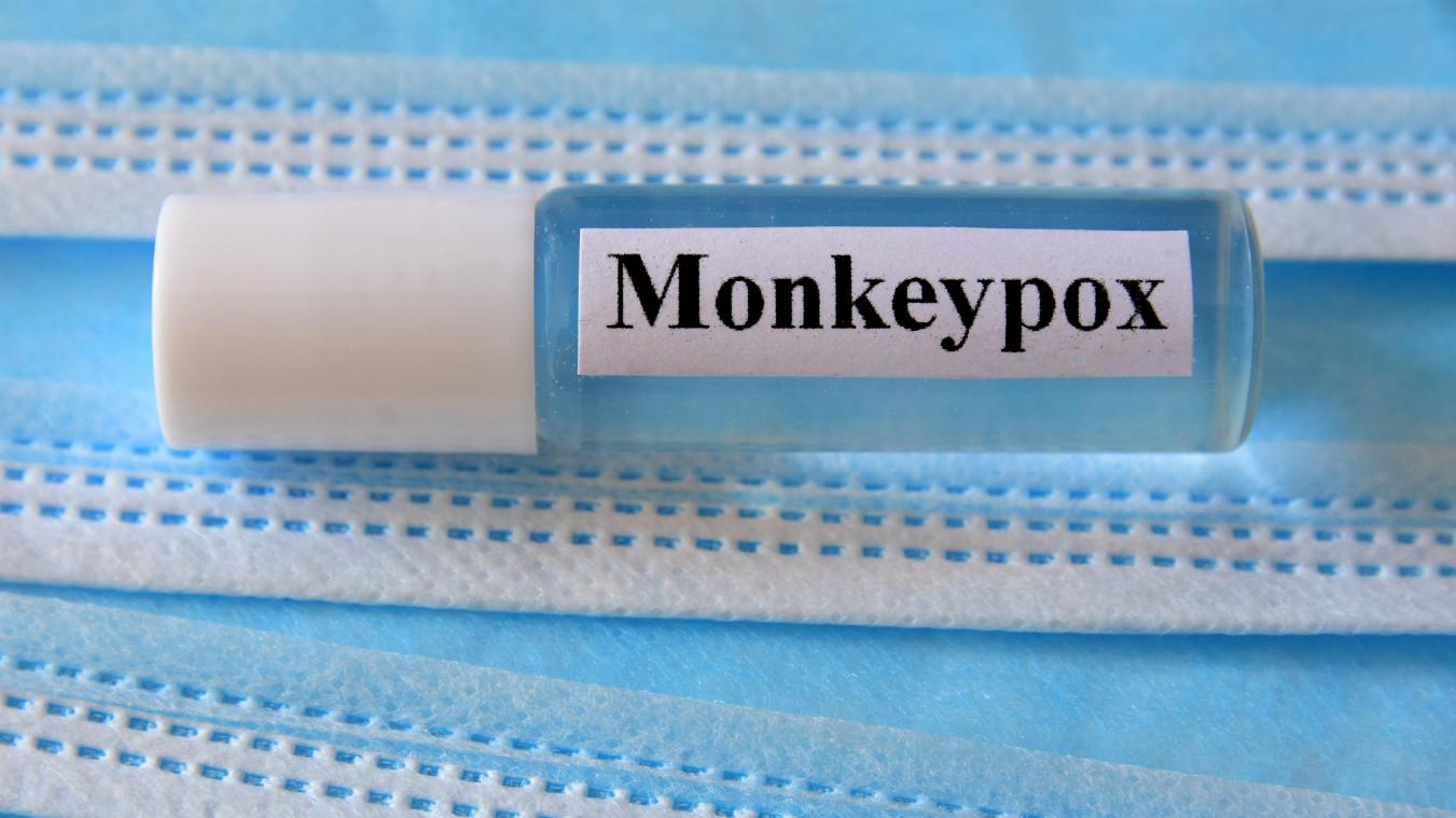Faut-il craindre une pandémie mondiale de variole du singe?