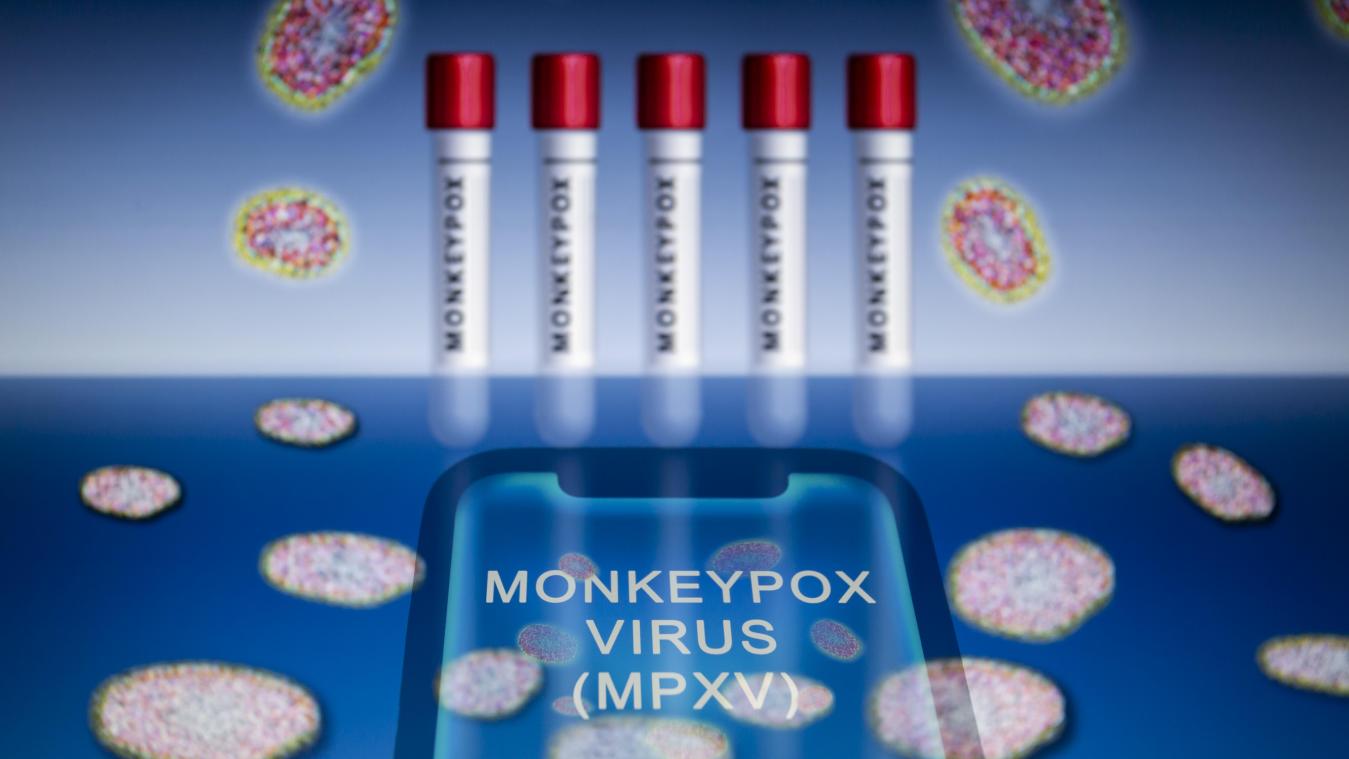 L’Institut de santé publique allemand recommande la vaccination contre la variole du singe pour les personnes à risque
