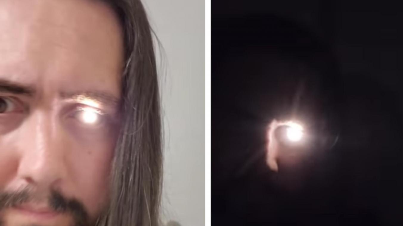 Il transforme sa prothèse oculaire en lampe de poche après un cancer de l’œil (vidéo)